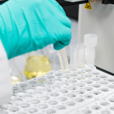equipos de cromatografia en laboratorio