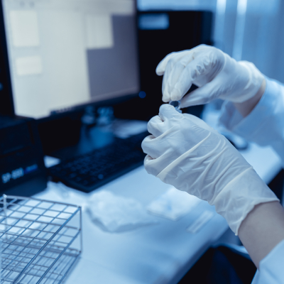 hplc laboratorio